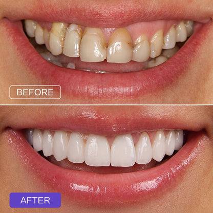 Purple Toothpaste Tablets-Fluoride-free oral care
