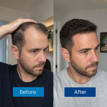 Hair Growth Roll-On