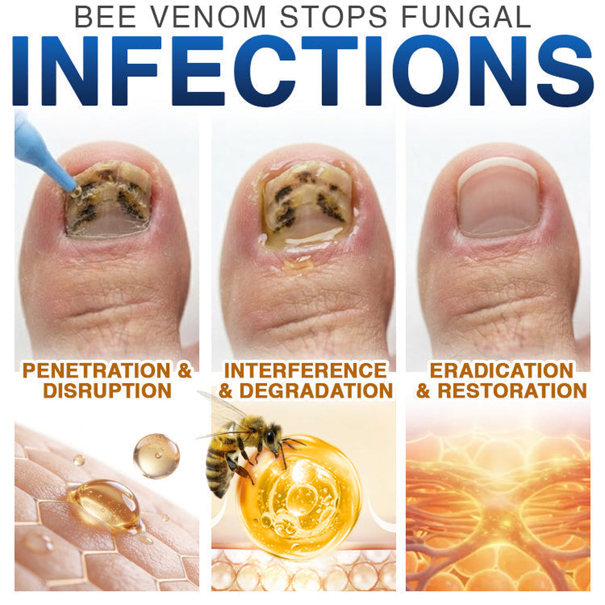 Bee Venom Nail Treatment, Fungi‑Free Nail Care Formula