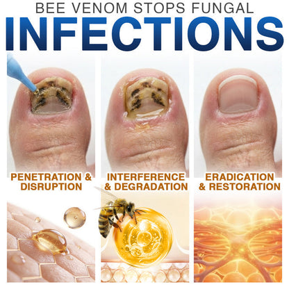 Bee Venom Nail Treatment, Fungi‑Free Nail Care Formula