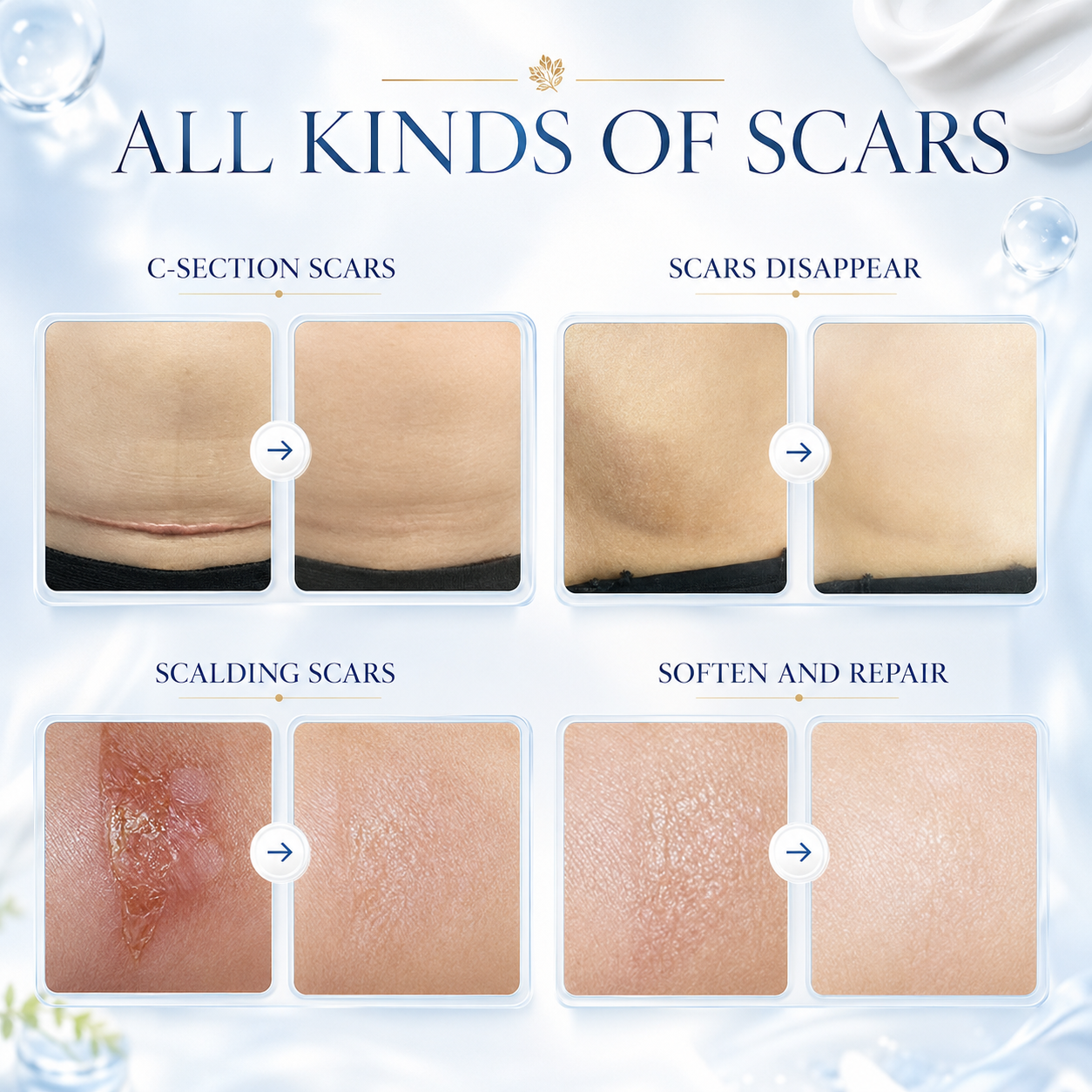 Scar cream product result display