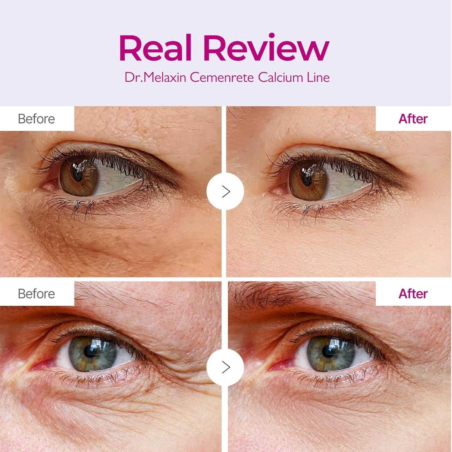 Brightening Eye Cream for Dark Circles