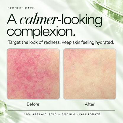 Azelaic Acid 10% + Hyaluronic Acid Soothing Serum, 30ml