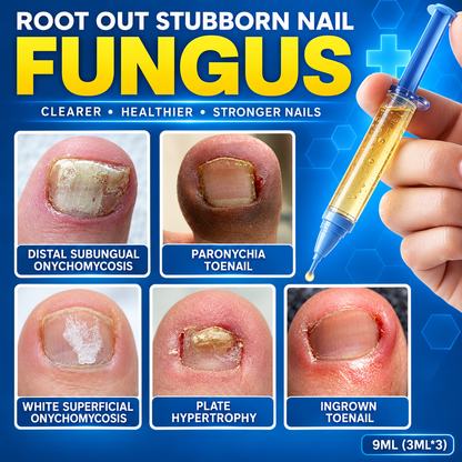 Bee Venom Nail Treatment, Fungi‑Free Nail Care Formula