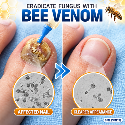 Bee Venom Nail Treatment, Fungi‑Free Nail Care Formula