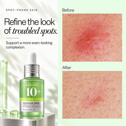 Azelaic Acid 10% + Hyaluronic Acid Soothing Serum, 30ml