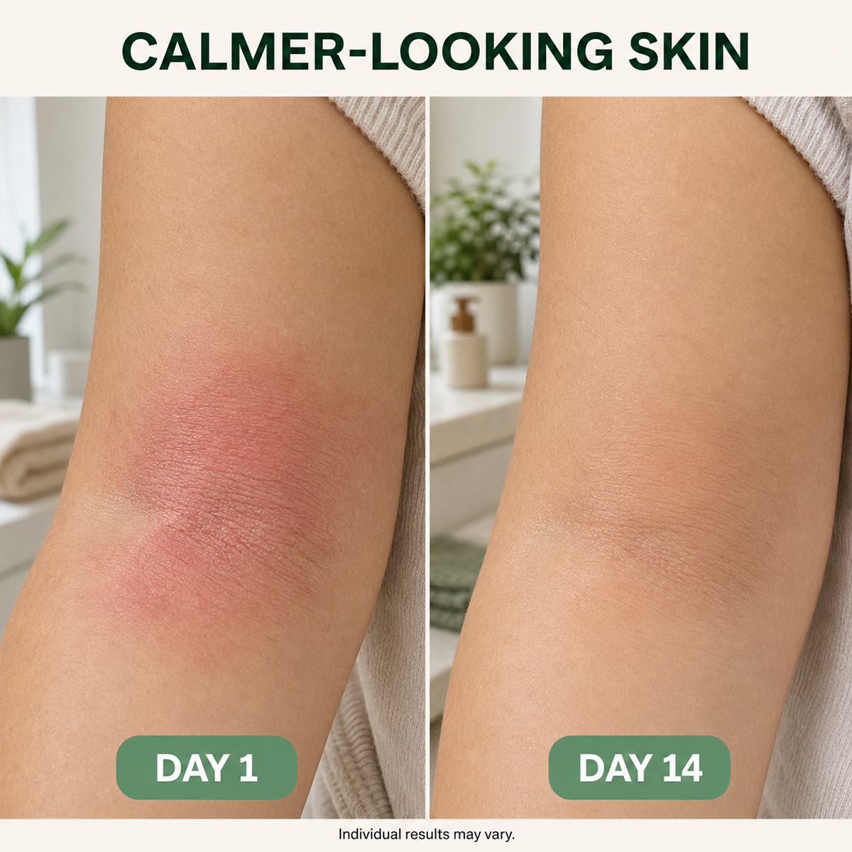 Intertrigo Relief Cream