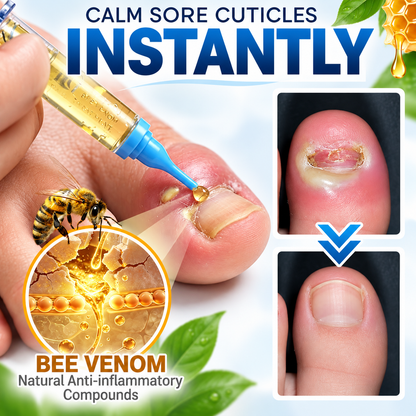 Bee Venom Nail Treatment, Fungi‑Free Nail Care Formula
