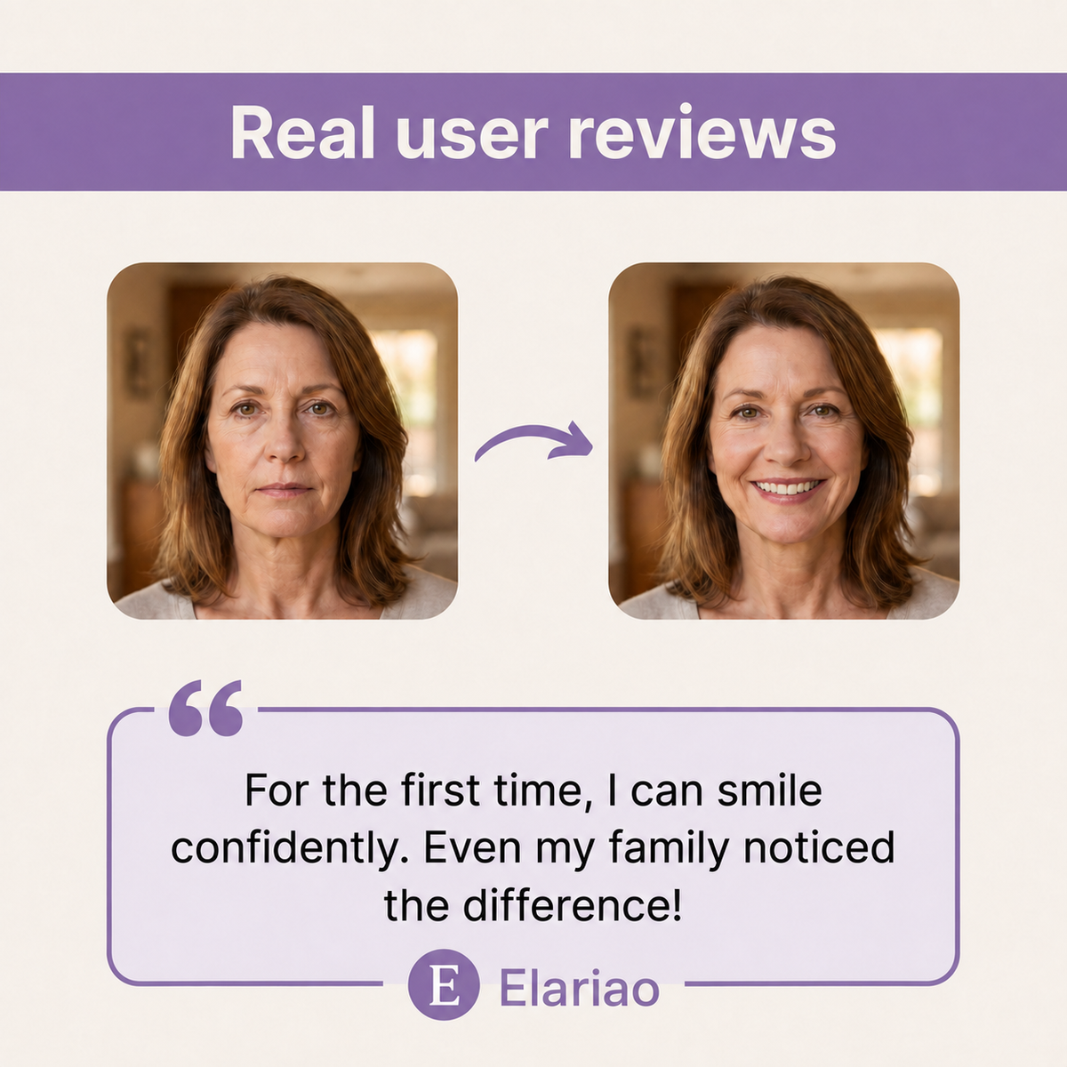 Elariao Custom Denture Set