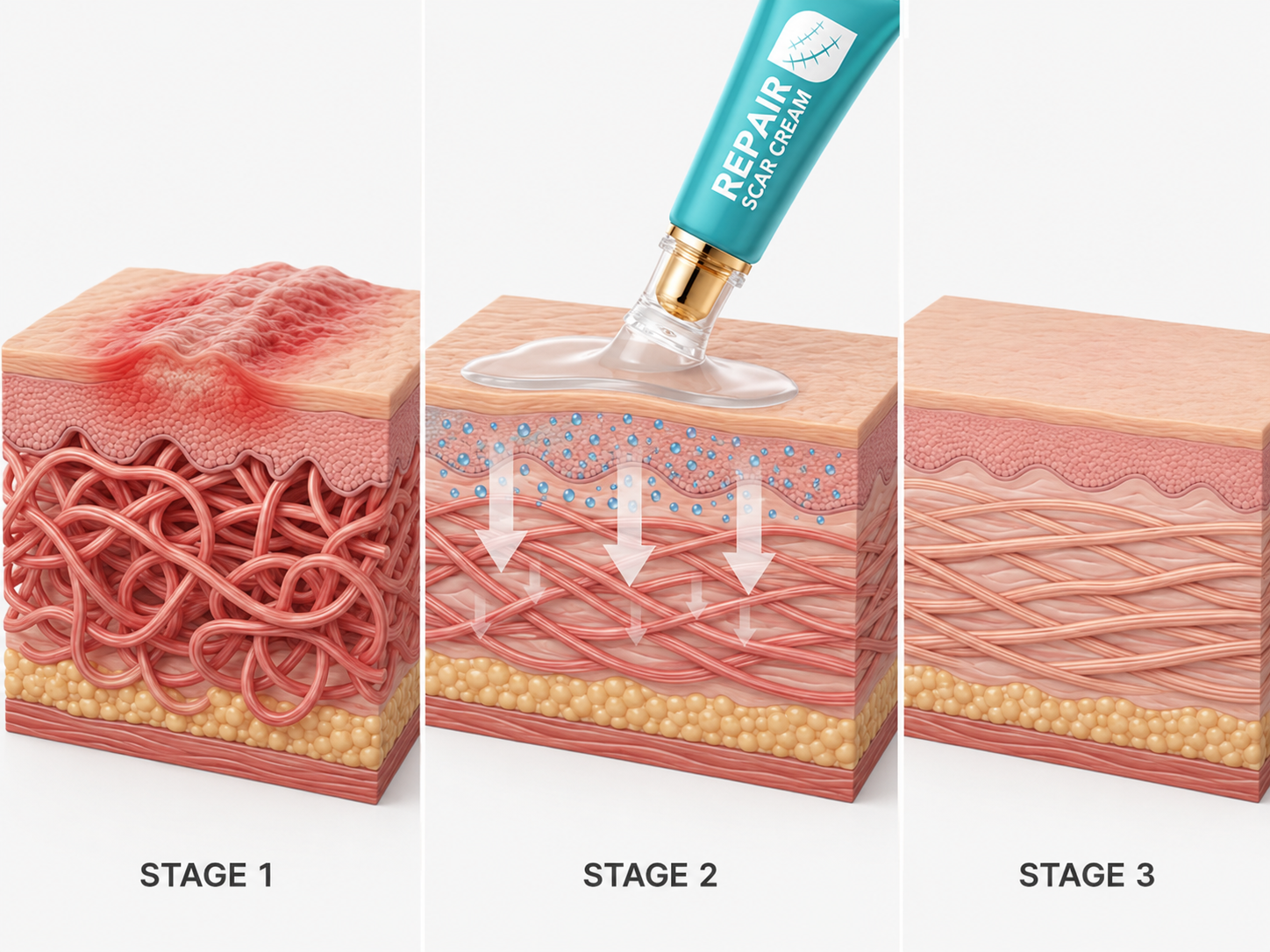How scar care cream works