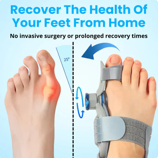 Toe Alignment Corrector Sleeve